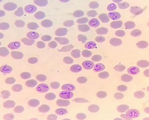An insight into Bovine Babesiosis – epashupalan