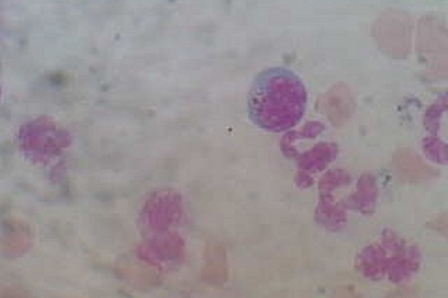 Buffy coat smear: light blue stained morula in the monocytes