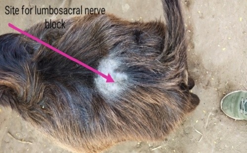 Site for lumbo sacral nerve block